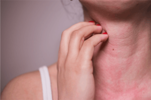 A women scratching her skin on her neck due to allergies. The benefits of using natural cleaning products for allergy sufferers.